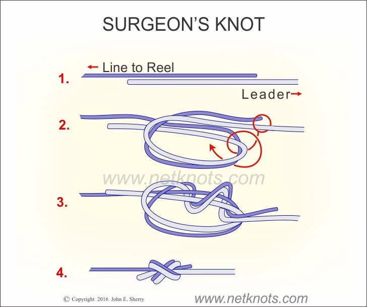 surgeons knot